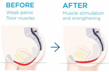 EMSELLA ABERDEEN SCOTAND 34535333 FillWzk0NSw2MzBd