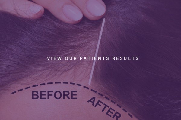 VIEW OUR PATIENT RESULTS
