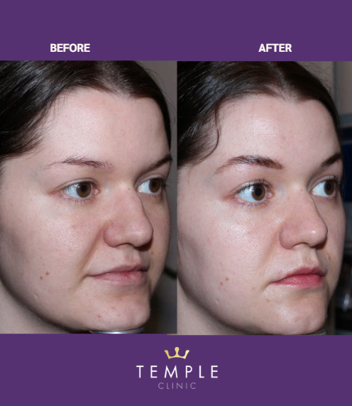 babyglow aberdeen before and after